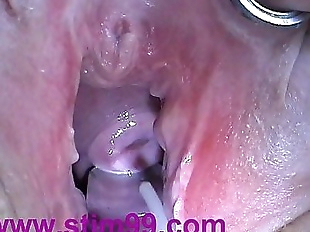 Cum Injection with Syringe in Cervix Utherus..
